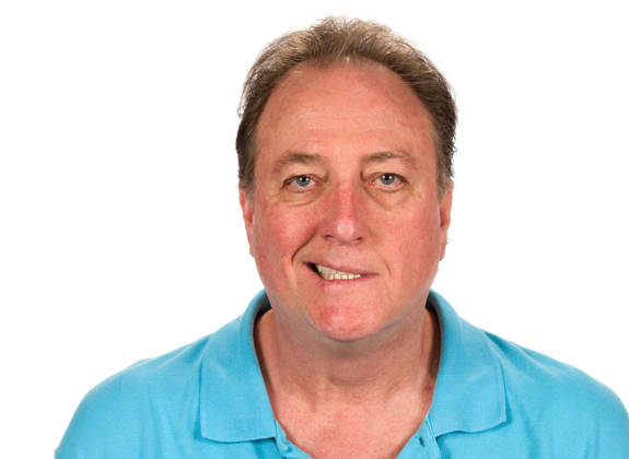 Middle-aged man with facial asymmetry due to facial palsy