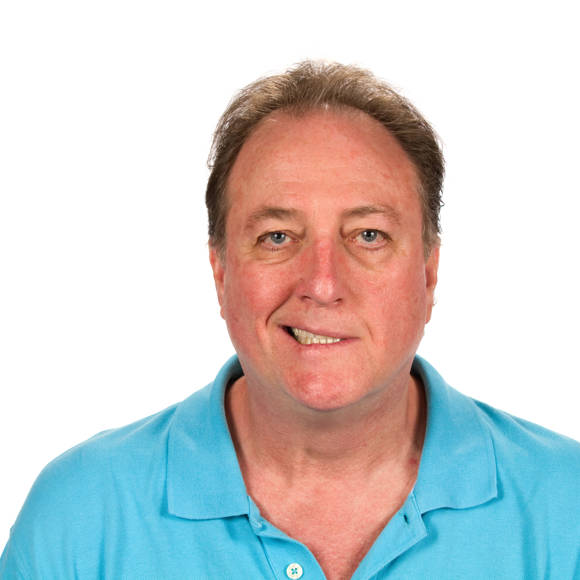 Middle-aged man with facial asymmetry due to facial palsy