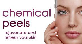 chemical peels