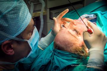 Dr Ioannis Liapakis performing advanced facial plastic surgery procedure